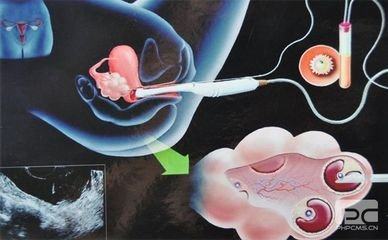 案例